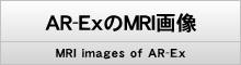 AR-ExのMRI画像