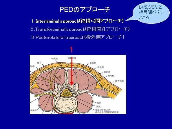 何でも揃う テキスト付き 劇的ヘルニア 頭蓋骨•内臓アプローチ 健康