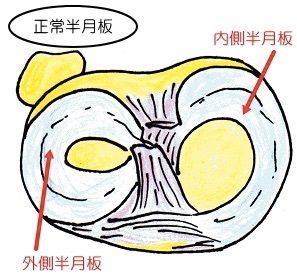 鏡視下半月板縫合術 部分切除術 都立大整形外科クリニック