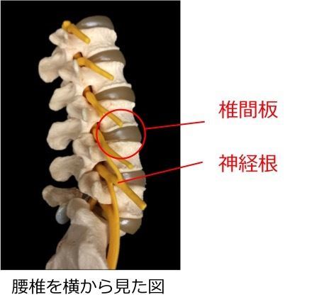 椎間関節性腰痛 | アレックス脊椎クリニック