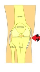 膝の内側靭帯損傷の原因と治療法 膝関節内側側副靭帯 Mcl 損傷 長野整形外科クリニック