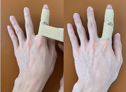 突き指の対処法とテーピング 佐久平整形外科クリニック