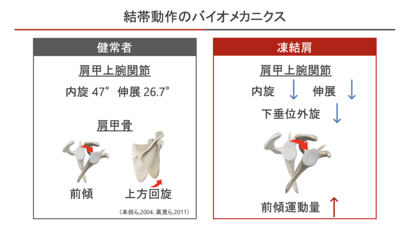 第50回日本肩関節学会学術集会/第20回肩の運動機能研究会 参加報告 | AR-Ex 尾山台整形外科