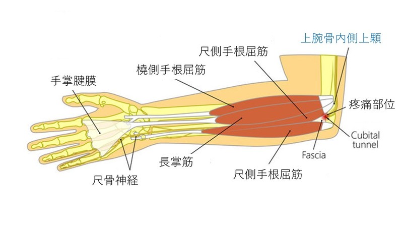 腕枕 オファー 尺側手根屈筋