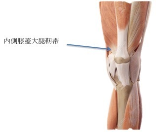 反復性膝蓋骨脱臼に対する内側膝蓋大腿靭帯（MPFL:medial 