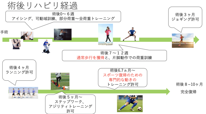 前十字靭帯の手術後のリハビリ | AR-Ex Medical Group