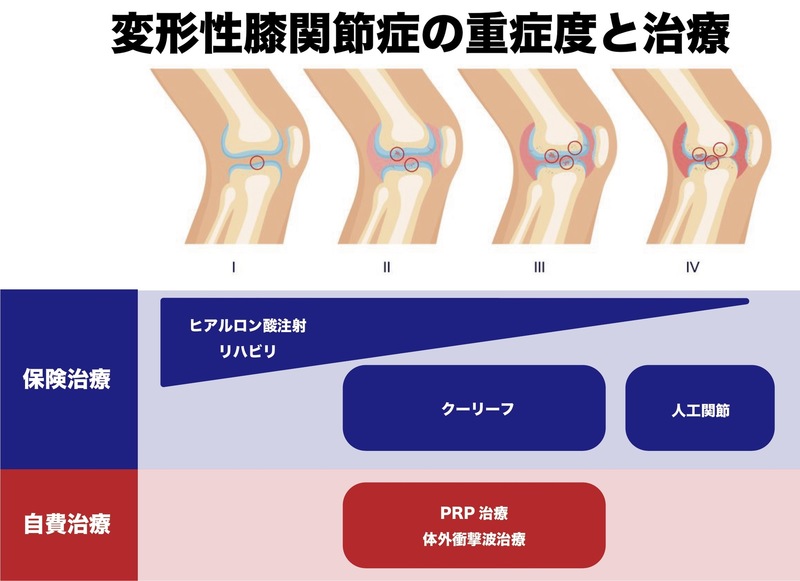 Coolief | AR-Ex スポーツ・難治性疼痛外来