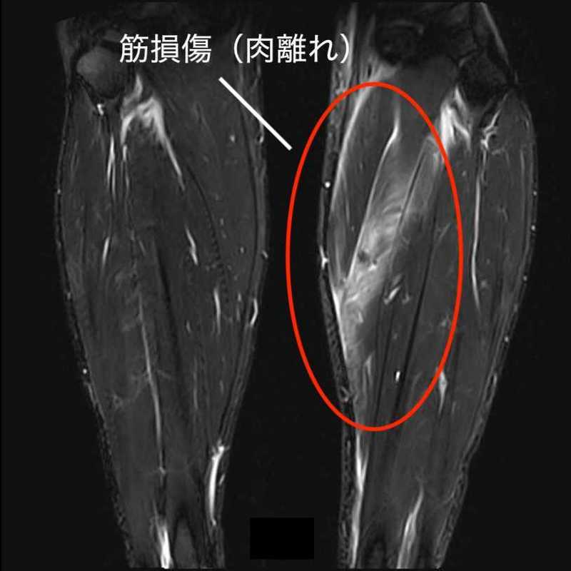 MRI検査で早期診断・早期治療へ | 佐久平整形外科クリニック