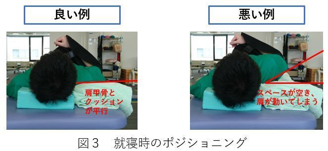 鏡視下腱板修復術（ARCR）術後リハビリテーション | 上田整形外科内科