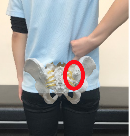 仙腸関節性腰痛の症状とその運動療法 ストレッチについて アレックス脊椎クリニック