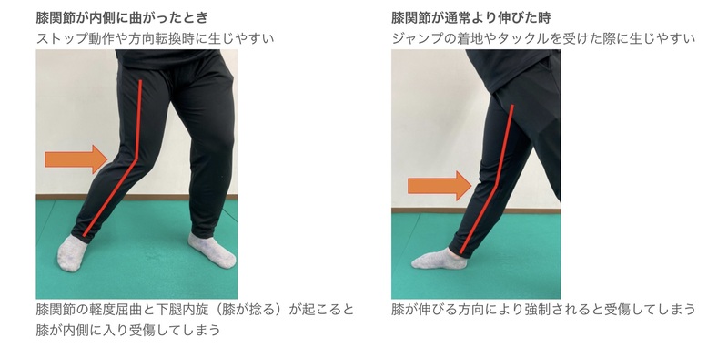 下肢 スポーツリハビリテーション ※週末限定値下げ 楽天市場】Activital 選べる2足セット 超立体 フットサポーター