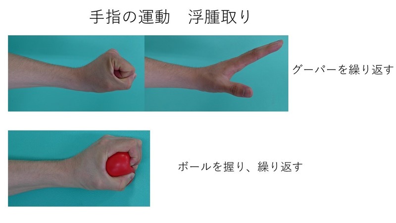 橈骨遠位端骨折 | 上田整形外科内科