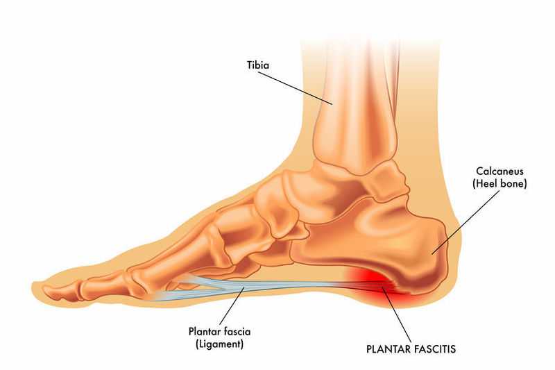 腱と筋肉の付着部の痛みと治療 都立大整形外科クリニック