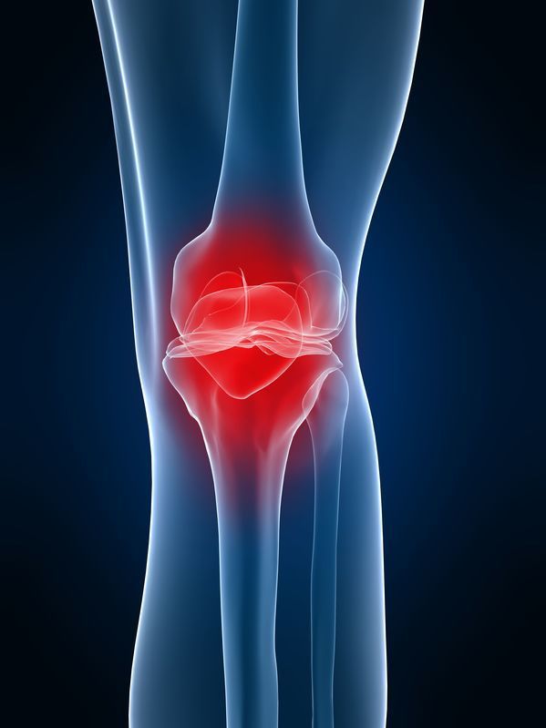 膝関節 軟骨と半月板 の痛みと治療 都立大整形外科クリニック