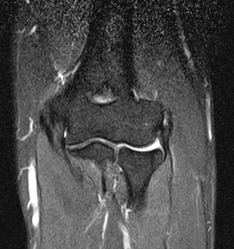 関節のMRI 肘関節外来 | 上田整形外科内科