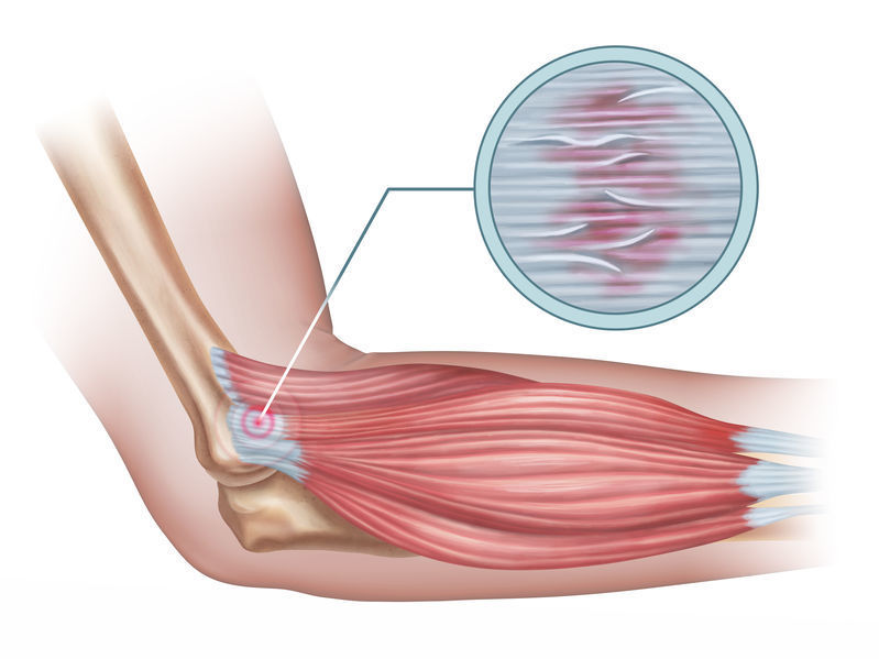 前腕の屈筋群と伸筋群について 都立大整形外科クリニック