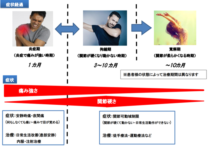 凍結肩（肩関節拘縮） | 上田整形外科内科