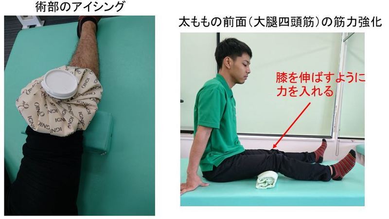 前十字靭帯再建術 | 上田整形外科内科