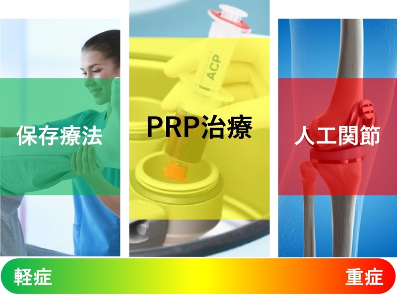 PRP治療 －自分の血液を利用する再生医療－ | 佐久平整形外科