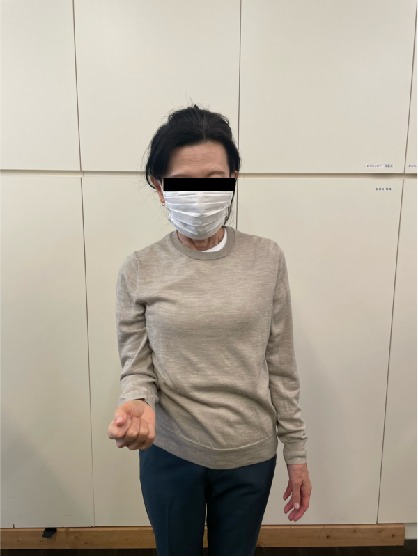 肩の動きづらさと夜間痛がサイレントマニピュレーションにより 肩の動きづらさと夜間痛がサイレントマニピュレーションにより