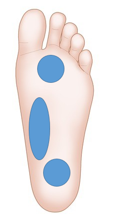 足底筋膜炎について 都立大整形外科クリニック