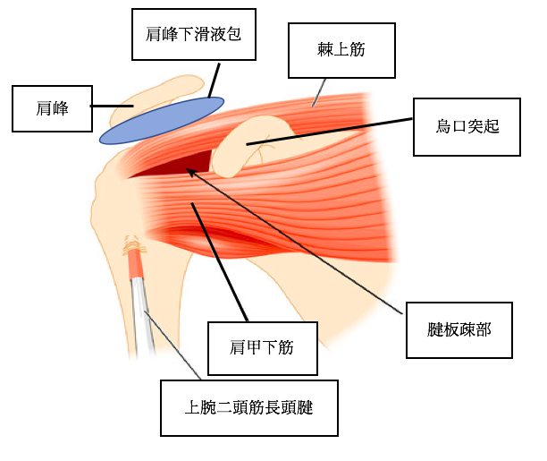 腕を動かすと引っかかる 肩峰下インピンジメント症候群 Ar Ex 尾山台整形外科