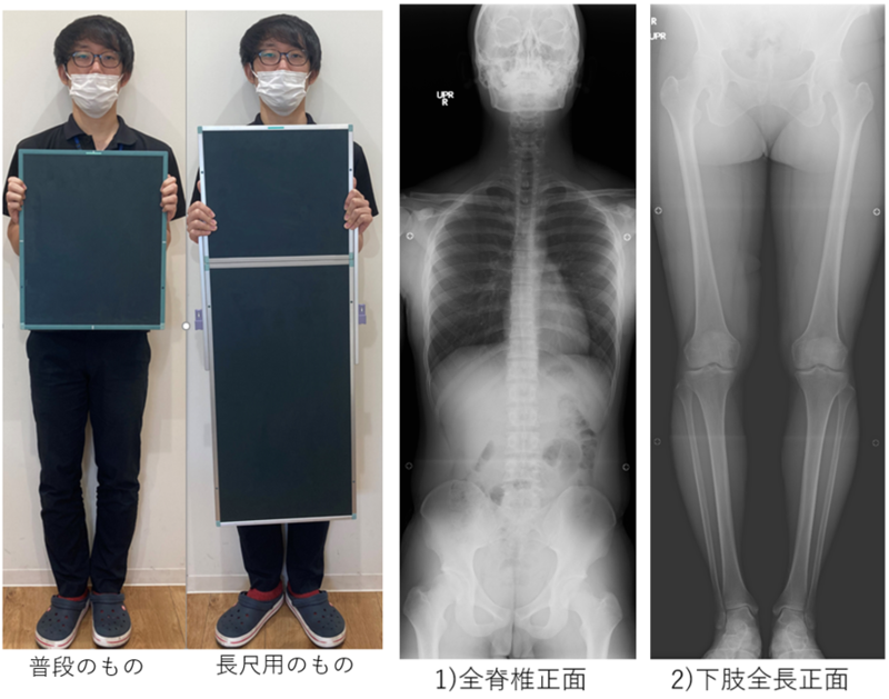 レントゲン検査 | アレックス脊椎クリニック