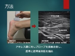 第32回日本整形外科超音波学会学術集会 参加報告 | 都立大整形外科 