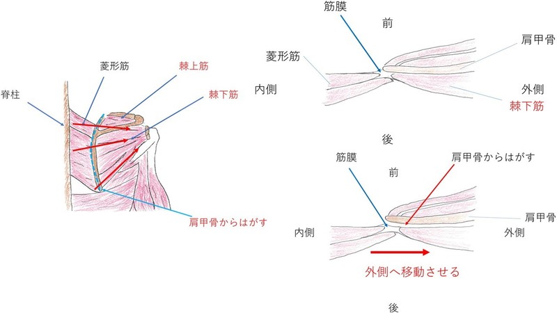 鏡視下腱板修復術（Debeyre-Patte変法）術後リハビリテーション | 上田