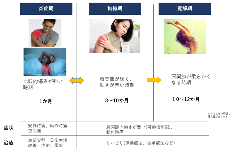 五十肩について 肩が痛い、硬い、動きが悪い | さいたま整形外科クリニック