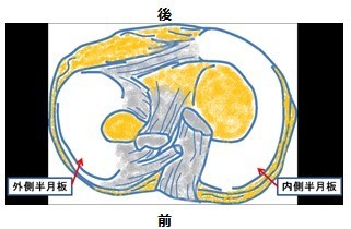 鏡視下半月板切除術又は縫合術 半月板損傷に対する手術 Ar Ex 尾山台整形外科