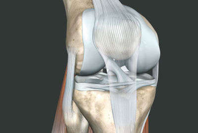 治りづらい膝蓋腱炎の治療方法
